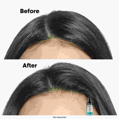 스칼프 안티 오일리니스 5-in-1 세럼 - 스칼프 어드밴스드 | L'Oréal 파트너샵